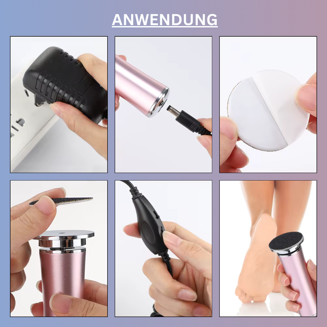 Samtfuss Pro - Elektrischer Hornhautentferner